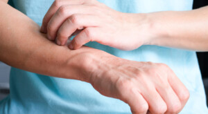 The man's hands he uses his hands to scratch his back because of dermatitis and itch sensation.